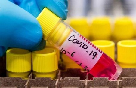 З підозрою на коронавірус до медиків звернулось ще 60 осіб