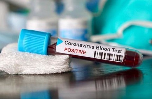 У Львові за добу тестування виявило ще 13 хворих на COVID-19