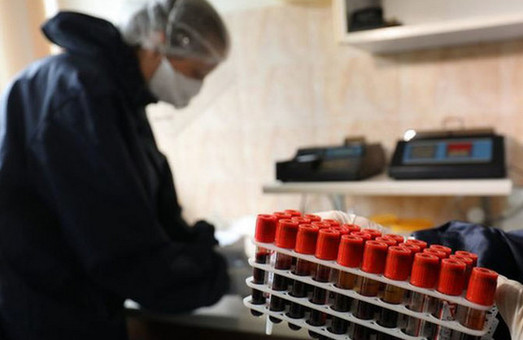 Головний медик Львова розказав про результати ІФА-тестування для виявлення антитіл до коронавірусу