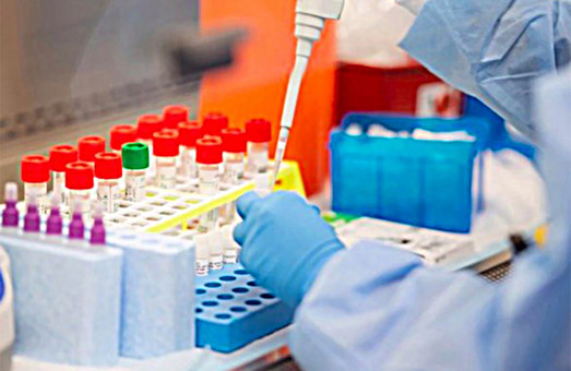 У Львові провели уже 13 тисяч ІФА-тестів на антитіла до коронавірусу, їх виявили у майже 12,5 % обстежених