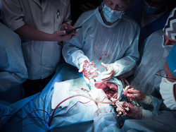 У львівській «лікарні на Топольній» провели першу операцію із видалення масивної пухлини шиї