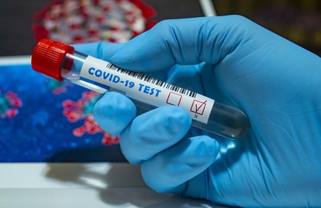 У Дрогобичі на Львівщині роблять безкоштовні ІФА-тести для виявлення імуноглобуліну Ig A до коронавірусу