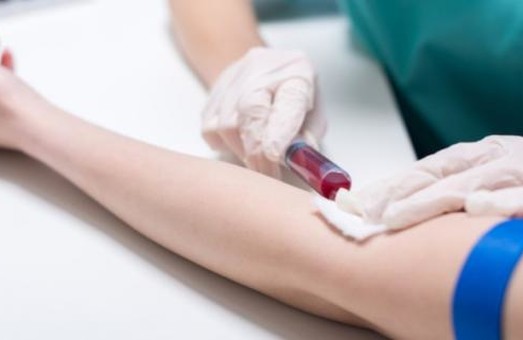 Мешканців Льівщини закликають перевіритися на гепатит С і ВІЛ
