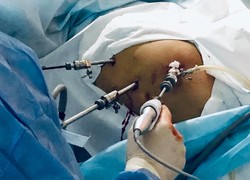 Протягом тижня, що минає, у Львові в «лікарні на Топольній» провели дві операції із трансплантації нирки
