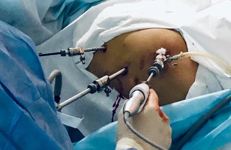 Протягом тижня, що минає, у Львові в «лікарні на Топольній» провели дві операції із трансплантації нирки